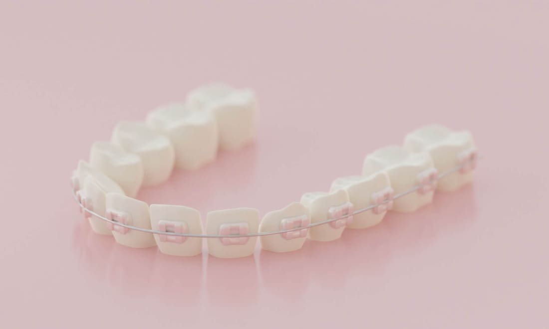 Ein Vorschaubild aus Stefans Website zur zweiten Meinung